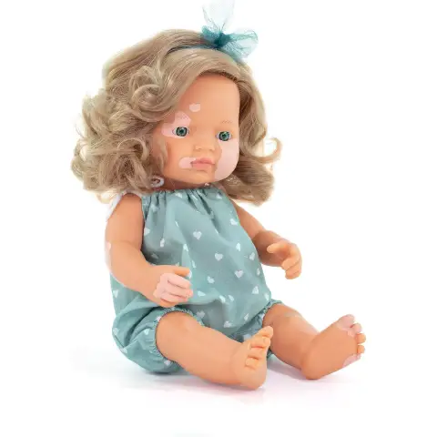 Inclusive Doll with Vitiligo, Diversity Educational Game